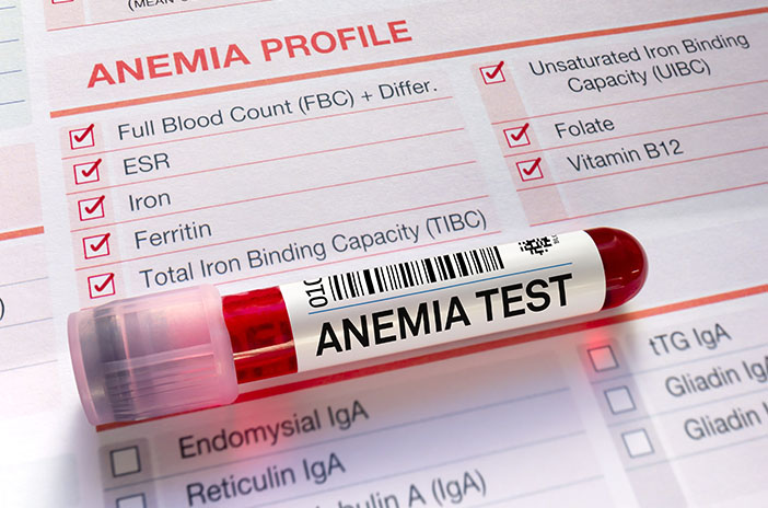  Anemia Hemolitik: Kenali Penyebab, Gejala, dan Cara Mengatasinya 
