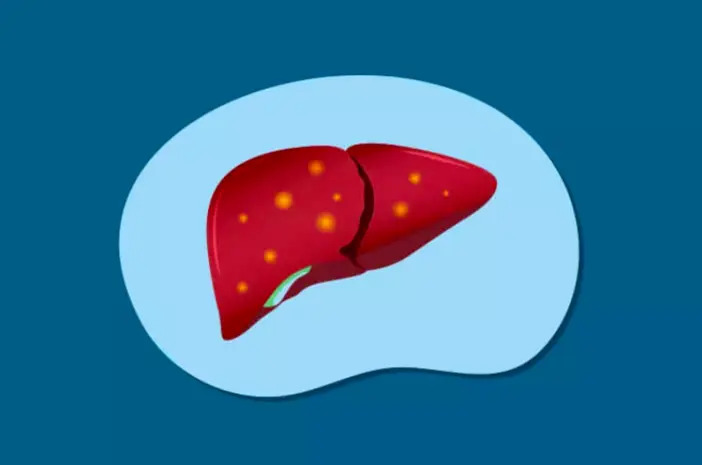 Hemokromatosis
