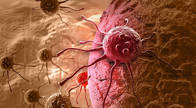 Mesmerizing Mesothelioma Spread To Brain Image Digital Art Mesmerizing Mesothelioma Spread To Brain Image Digital Art