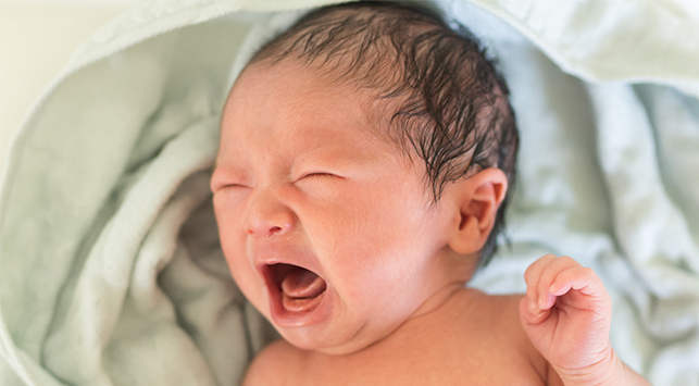 Gastroschisis
