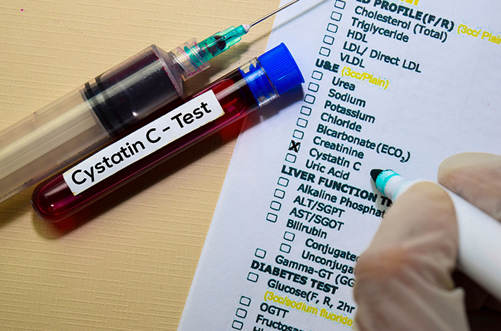 cek-cystatin-c-halodoc