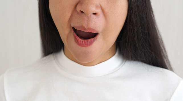 bell's palsy