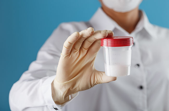 Sperma bilan toldirilgan teshiklar