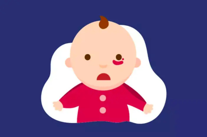 hemangioma adalah