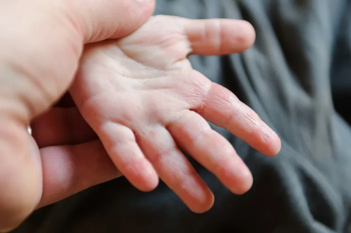 Jenis Infeksi Kulit pada Anak yang Sering Terjadi