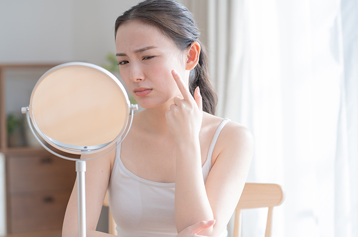 4 Cara Menghilangkan Bekas Jerawat Secara Alami