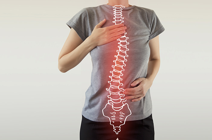 Bagaimana Cara Mencegah Terjadinya Lordosis?