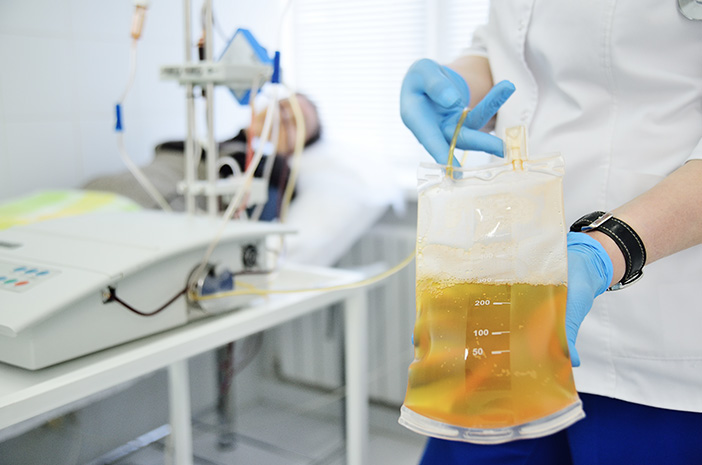 4 Kondisi Kesehatan yang Membutuhkan Donor Plasma Darah