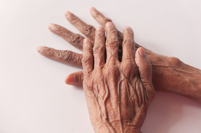 Tidak Sama, Ini Bedanya Parkinson dengan Parkinsonisme