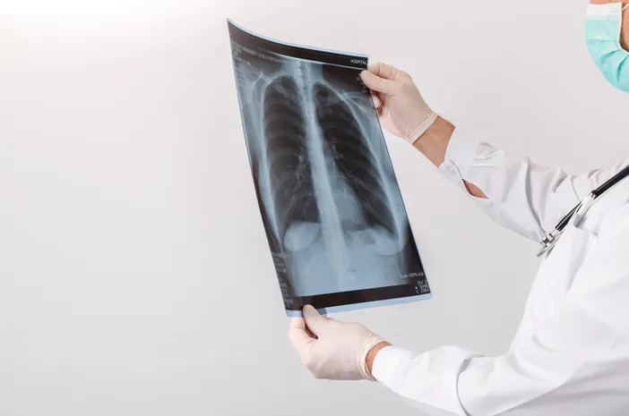 Ini Dampak Paru-Paru Basah yang Tidak Diobati