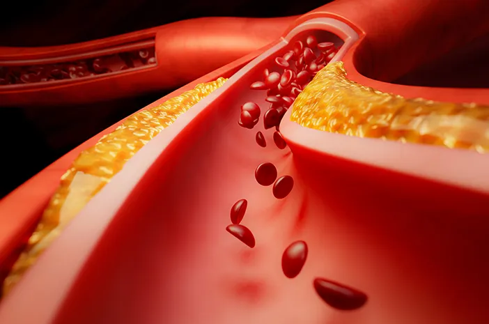 Mengenal Sistem Peredaran Darah Besar dan Kecil