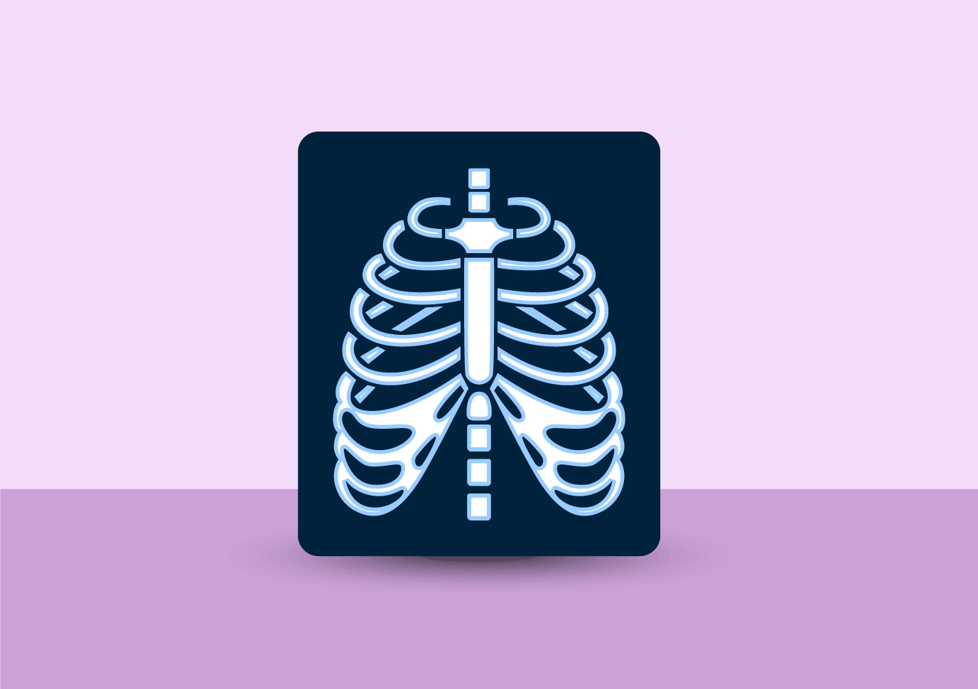 Ini 3 Fakta tentang Hantavirus Pulmonary Syndrome
