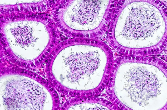 Muzlik davri porno multfilm