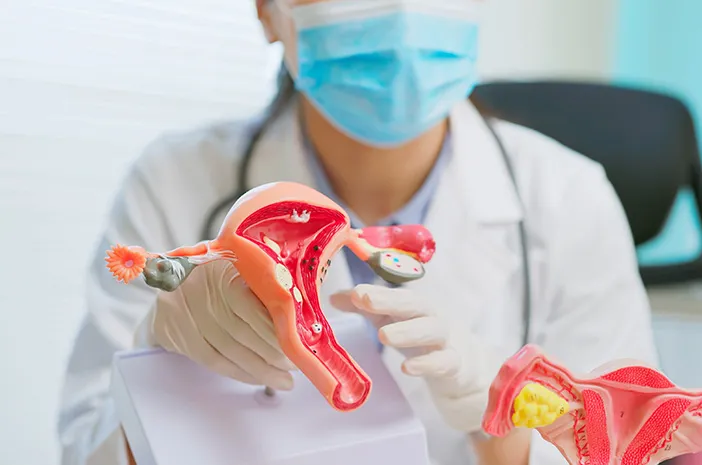 Ini Tanda Kanker Ovarium yang Harus Diketahui Wanita