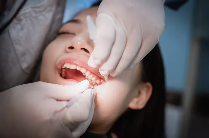 Biaya Cabut Gigi Geraham: Estimasi dan Faktor Penentu