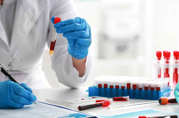 Mengapa Tes Kreatinin Fosfokinase Diperlukan?