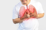 Mengenal Fibrosis Paru: Kenali Gejala dan Faktor Risikonya