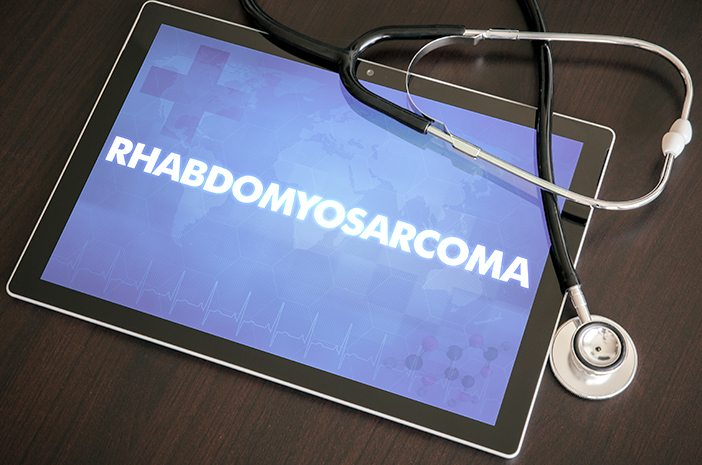 Rhabdomyosarcoma