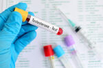 Ini Waktu Tepat untuk Pria Lakukan Cek Kadar Testosteron