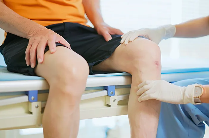 Harga Operasi ACL: Info Biaya dan BPJS Terbaru!