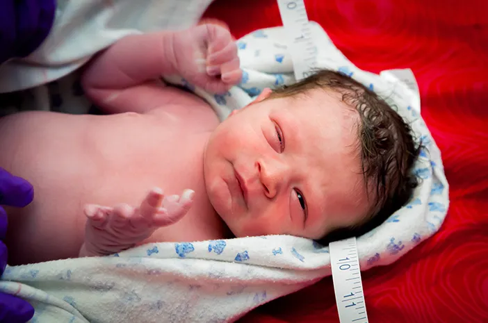 Kenali Retinopathy of Prematurity, Penyakit Mata Akibat Lahir Prematur