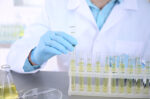 Protein Urine Positif 1-4: Arti, Penyebab, Cara Mengatasi