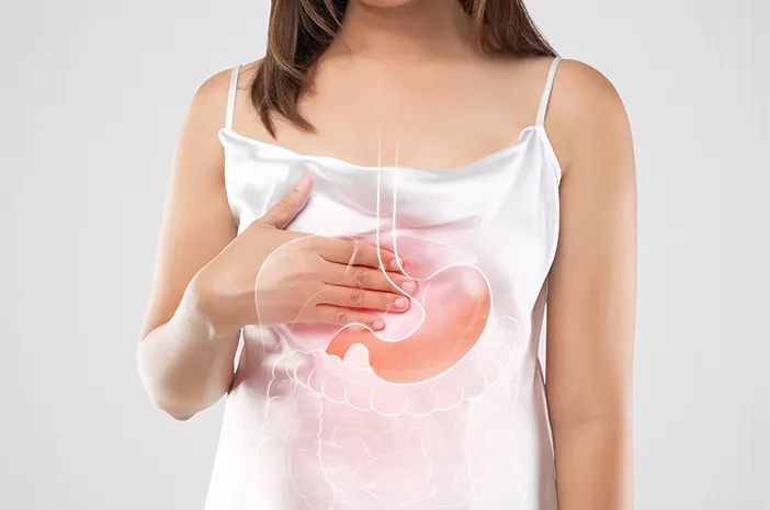Inilah 3 Penanganan untuk Bantu Meredakan GERD