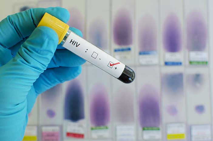 6 Faktor Utama Penularan HIV yang Jarang Disadari