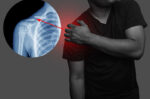 Cedera Collar Bone: Penyebab dan Cara Mengobatinya