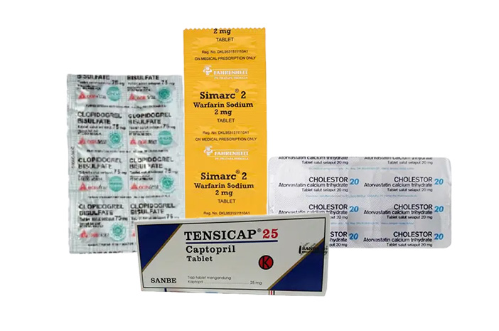 Penyebab stroke ringan