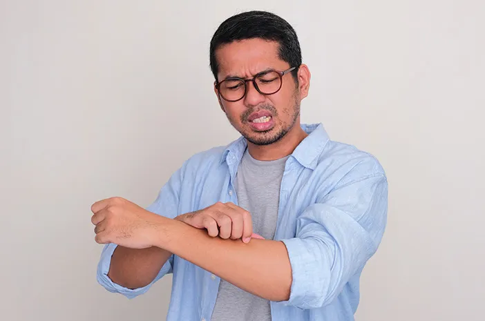 Panu, Ini Penyebab, Gejala dan Cara Mengobati