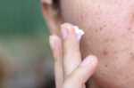 5 Cara Menghilangkan Flek Hitam di Hidung dengan Herbal Alami