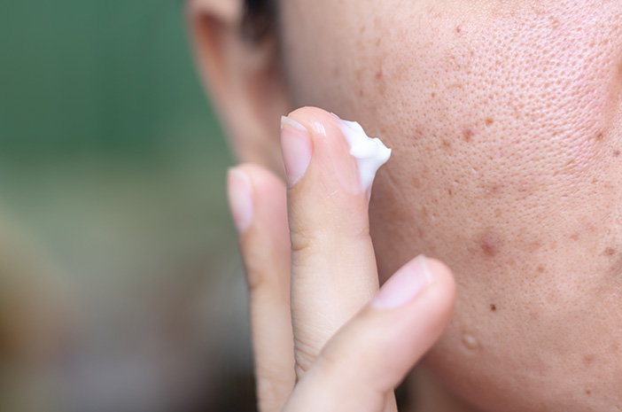 5 Cara Menghilangkan Flek Hitam di Hidung dengan Herbal Alami