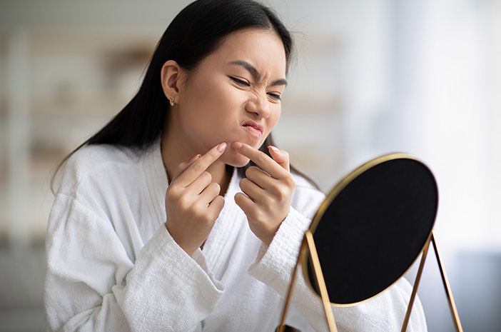 Cara mencegah jerawat agar tidak balik lagi
