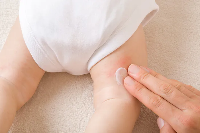 Ibu, Ini 5 Cara Memilih Popok Bayi untuk Mencegah Ruam Popok