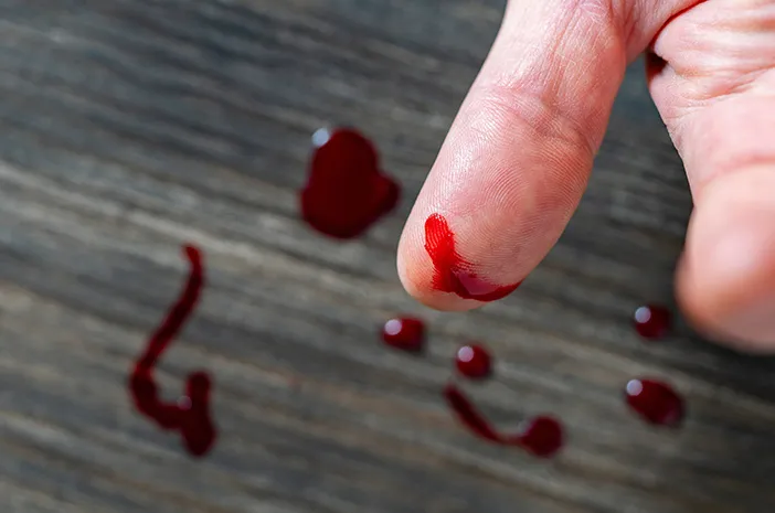 Tangan Luka Kena Pisau Silet, Ini Penanganan Pertama untuk Cegah Infeksi