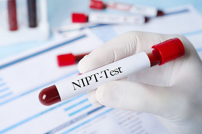 Ndpr Laboratorium Test Ree Pemeriksaan NIPT - Tujuan, Prosedur & Kapan Perlu Melakukan