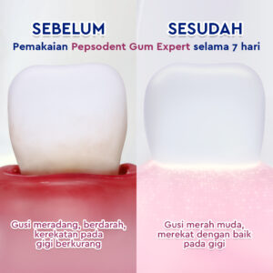 Pepsodent Gum Expert 100%