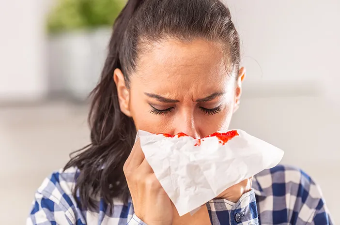 7 Penyebab Mimisan dan Cara Mengatasinya