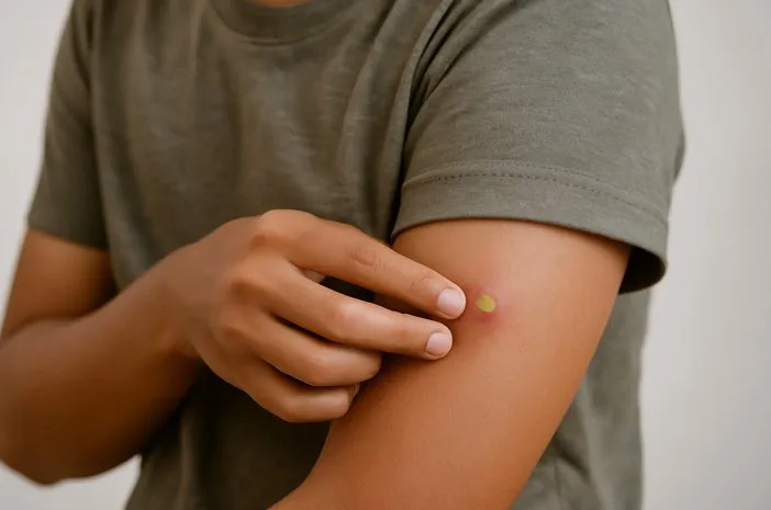 Nanah: Info Lengkap Penyebab, Gejala dan Cara Mengobati!