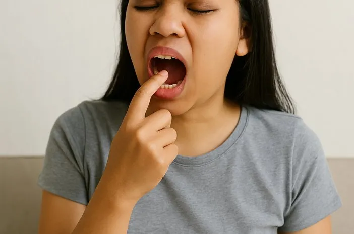 Langit Langit Mulut Gatal: Penyebab dan Cara Ampuh Mengatasinya