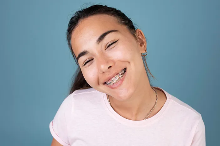 Harga Pasang Behel Terbaru? Ini Dia Estimasi Biayanya