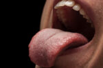 Strawberry Tongue: Gejala, Penyebab, dan Pengobatan