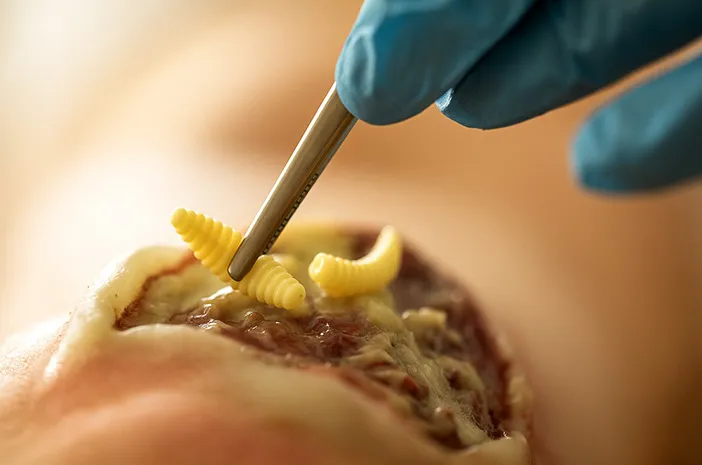 Belatung: Fakta Unik dan Cara Menghindarinya!