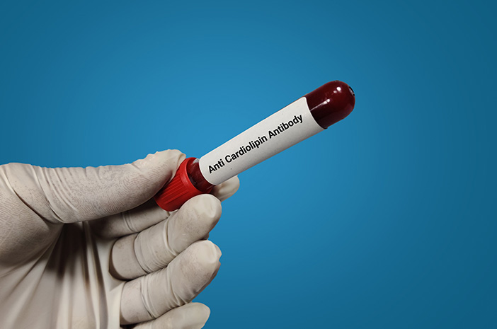Tes Anticardiolipin Antibodies (ACA) IgG, Pengertian, Manfaat, dan ...