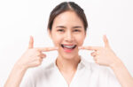 Mengenal Behel Self Ligating untuk Merapikan Gigi