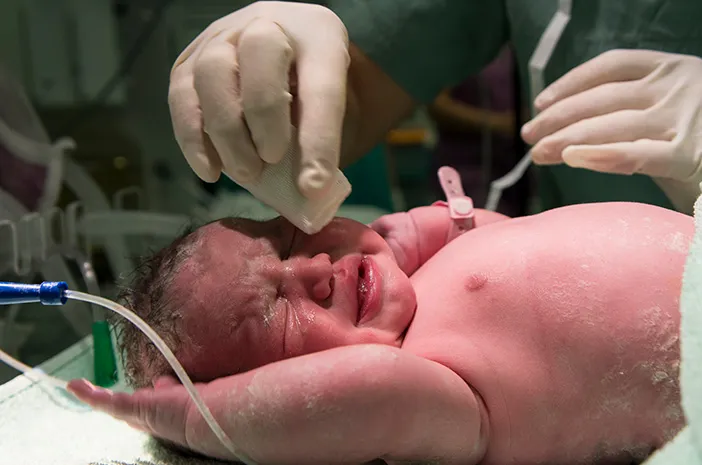 CPAP Bayi: Pengertian, Fungsi, dan Manfaatnya