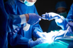 Cedera degloving adalah cedera traumatis serius berupa terlepasnya kulit dan jaringan lunak dari struktur di bawahnya.