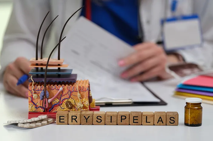 Mengenal Erisipelas, Infeksi Kulit Akibat Bakteri Streptokokus