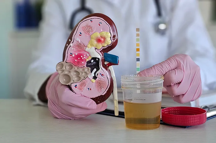 Urobilinogen Urine: Fungsi, Normal, dan Abnormal